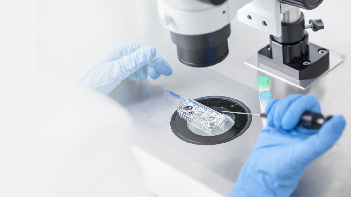 IVF คืออะไร