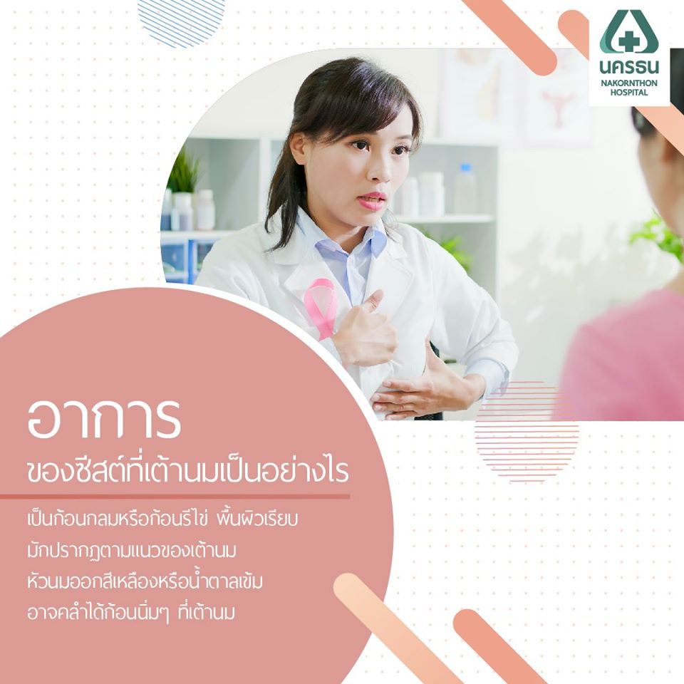 ซีสต์ในเต้านม, ถุงน้ำในเต้านม