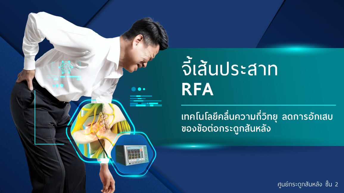 การจี้เส้นประสาท RFA
