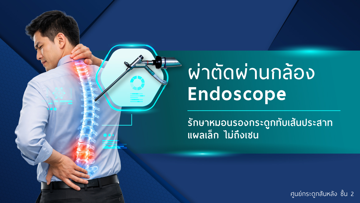 การผ่าตัดกล้อง Endoscope