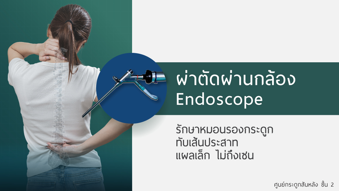 การผ่าตัดกล้อง Endoscope