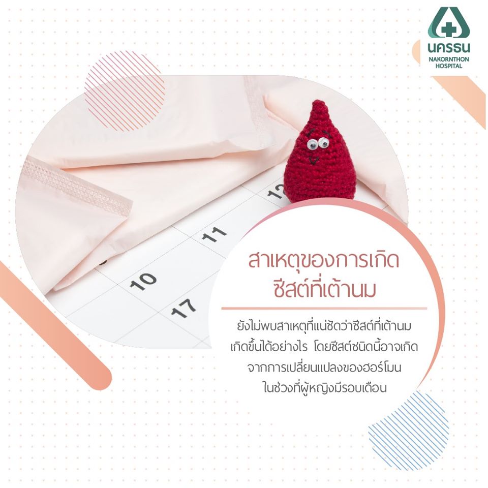 ซีสต์ในเต้านม, ถุงน้ำในเต้านม