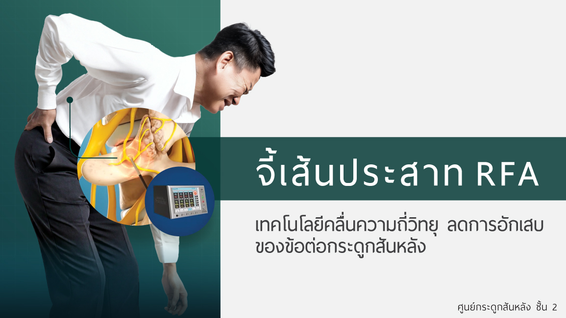 การจี้เส้นประสาท RFA