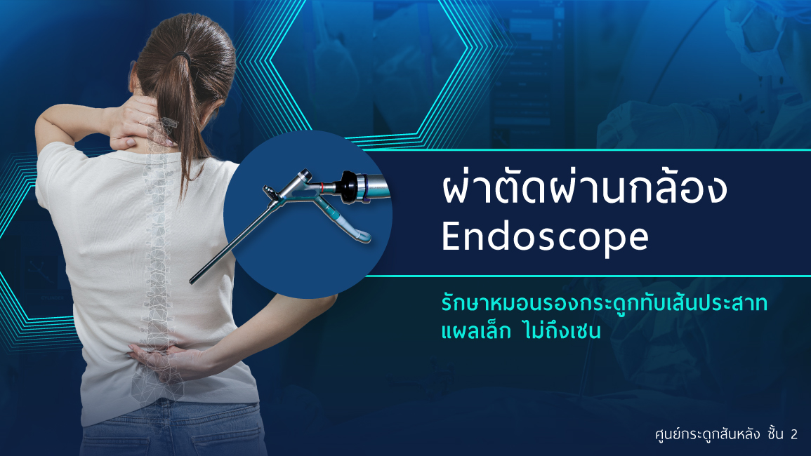 การผ่าตัดกล้อง Endoscope