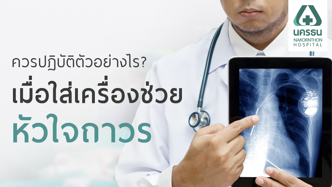 การใส่เครื่องกระตุ้นไฟฟ้าหัวใจ