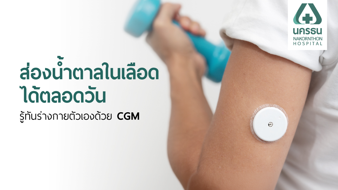 CGM