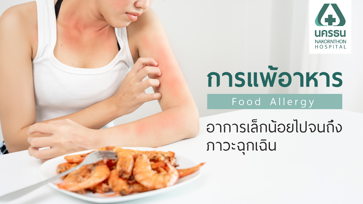 อาการแพ้อาหาร