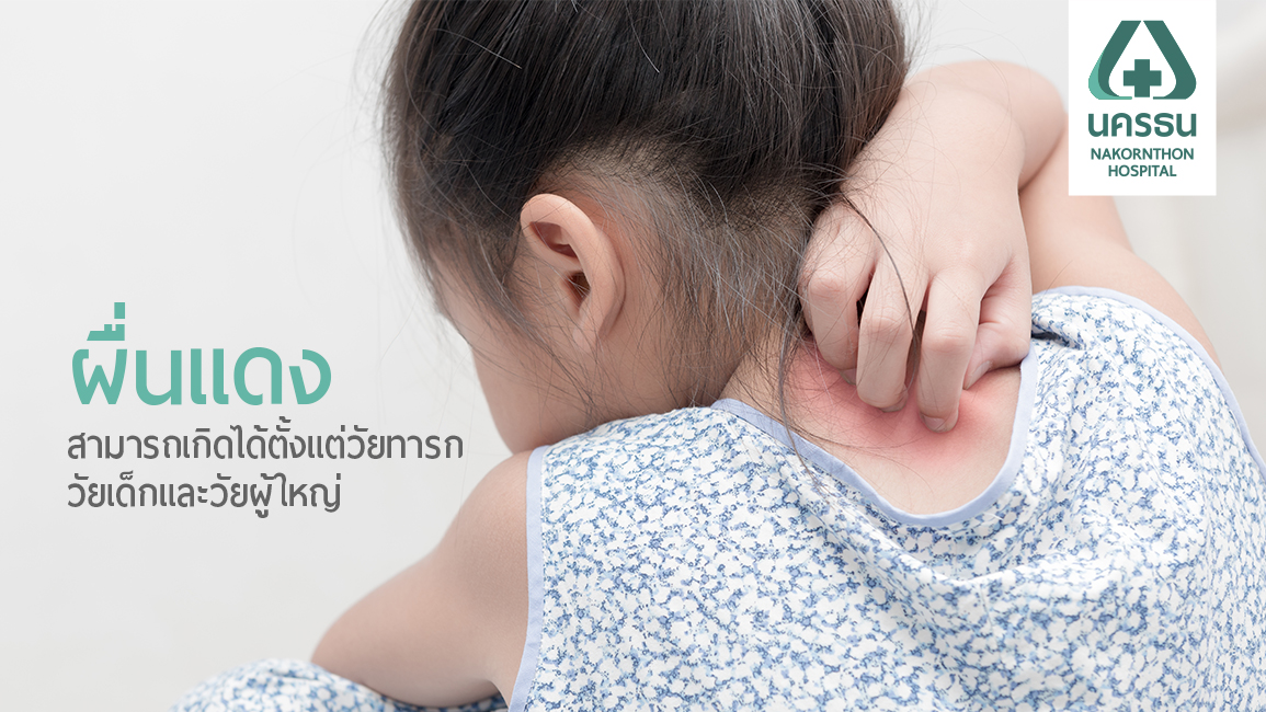 รู้จักให้มากขึ้นกับ โรคผื่นภูมิแพ้ทางผิวหนัง