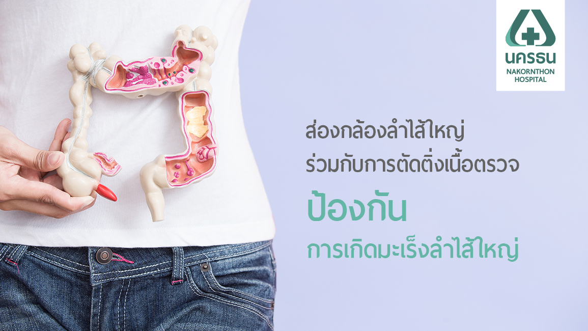 ส่องกล้องตรวจมะเร็งลำไส้ใหญ่ คัดกรองโรคร้ายก่อนลุกลาม