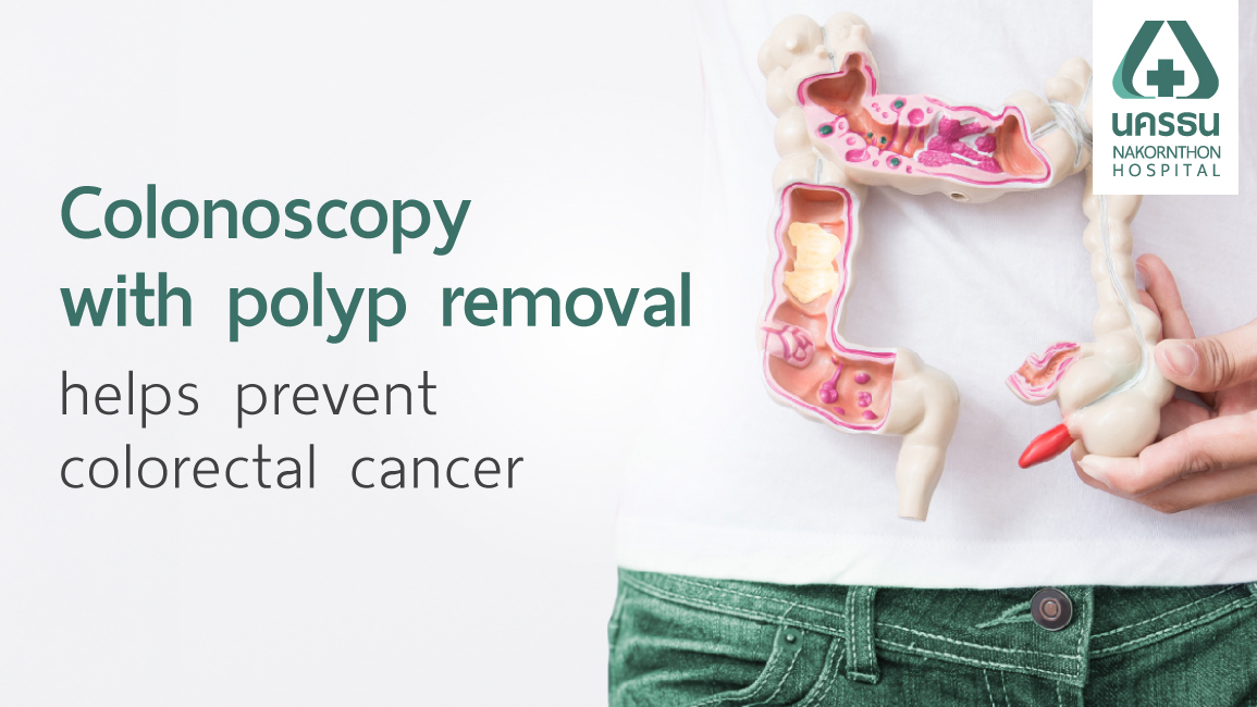 Colonoscopy