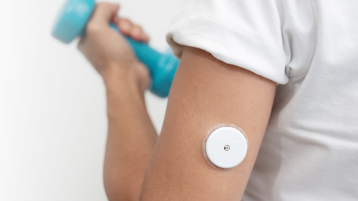CGM
