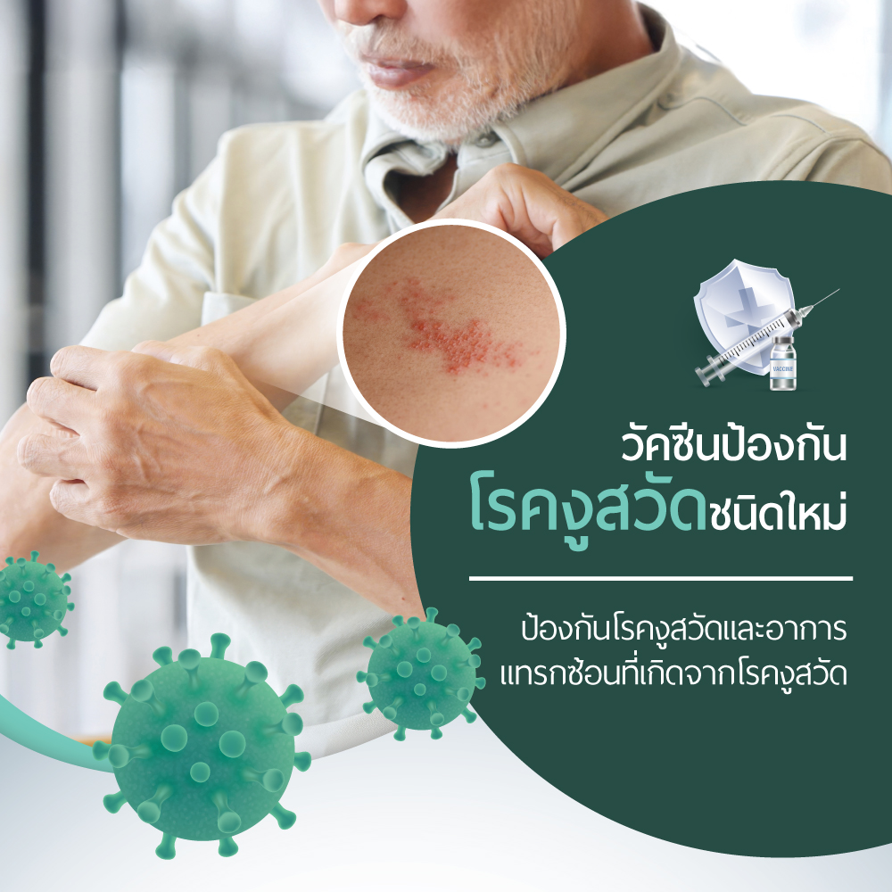 วัคซีนป้องกันโรคงูสวัด